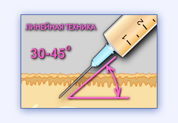 Коррекция атрофического рубца фильм для обучения косметологов